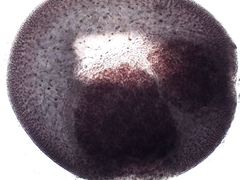 Chondracanthus teedei