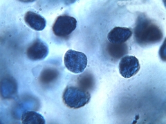 Chondracanthus teedei