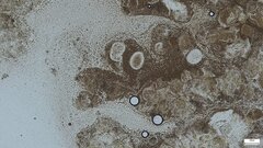 Basidiomycota