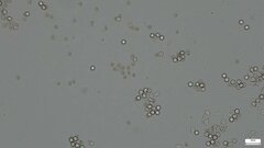 Basidiomycota