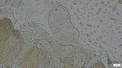Basidiomycota