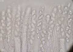 Peziza griseorosea
