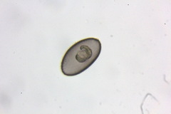 Protozoa