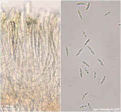 Chlorencoelia versiformis