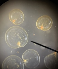 Noctiluca scintillans