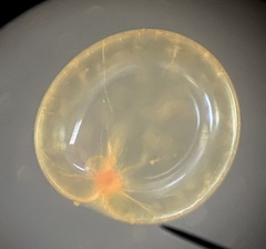 Noctiluca scintillans