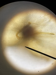 Noctiluca scintillans