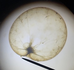 Noctiluca scintillans