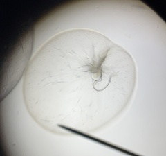 Noctiluca scintillans