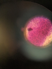 Bacteria