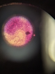 Bacteria