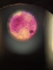 Bacteria