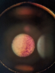 Bacteria