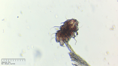 Echiniscus