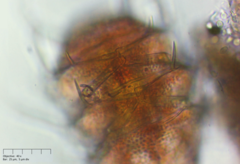 Echiniscus