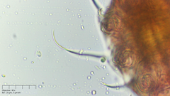 Echiniscus