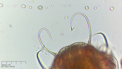 Echiniscus