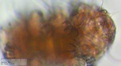 Echiniscus