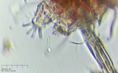 Echiniscus
