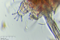 Echiniscus