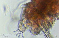 Echiniscus