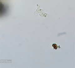 Amoebozoa