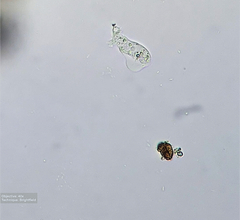 Amoebozoa