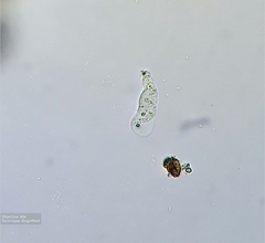 Amoebozoa