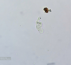 Amoebozoa