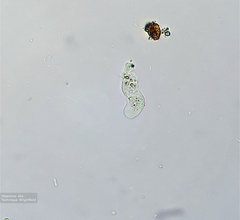 Amoebozoa