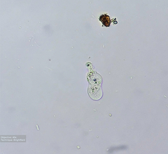 Amoebozoa