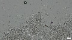 Ascomycota