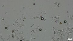 Ascomycota