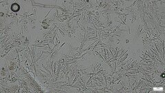Ascomycota