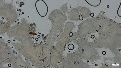 Ascomycota