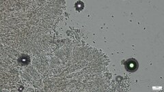 Ascomycota
