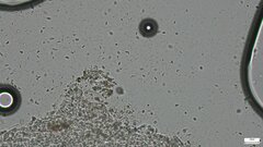 Ascomycota