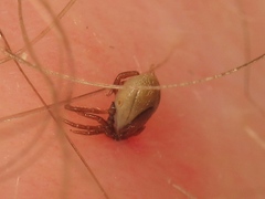 Ixodidae