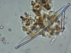 Hantzschia amphioxys