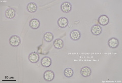 Pulvinula convexella