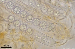 Pulvinula convexella