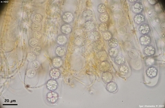 Pulvinula convexella