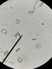 Heterosigma akashiwo