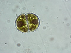 Staurastrum orbiculare