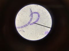 Sphagnum angustifolium