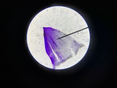 Sphagnum angustifolium