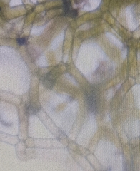 Hydrodictyon reticulatum