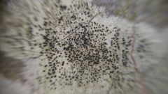 Lecidella elaeochroma