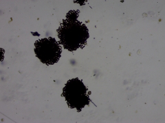 Dolichospermum lemmermannii