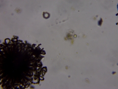 Dolichospermum lemmermannii